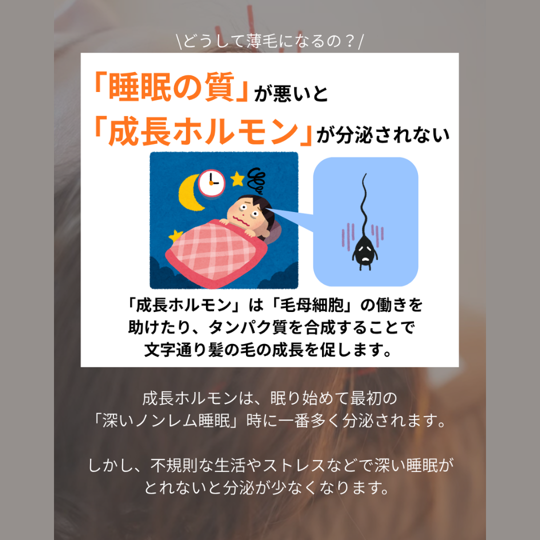 【薄毛の始まりはここからだった!】