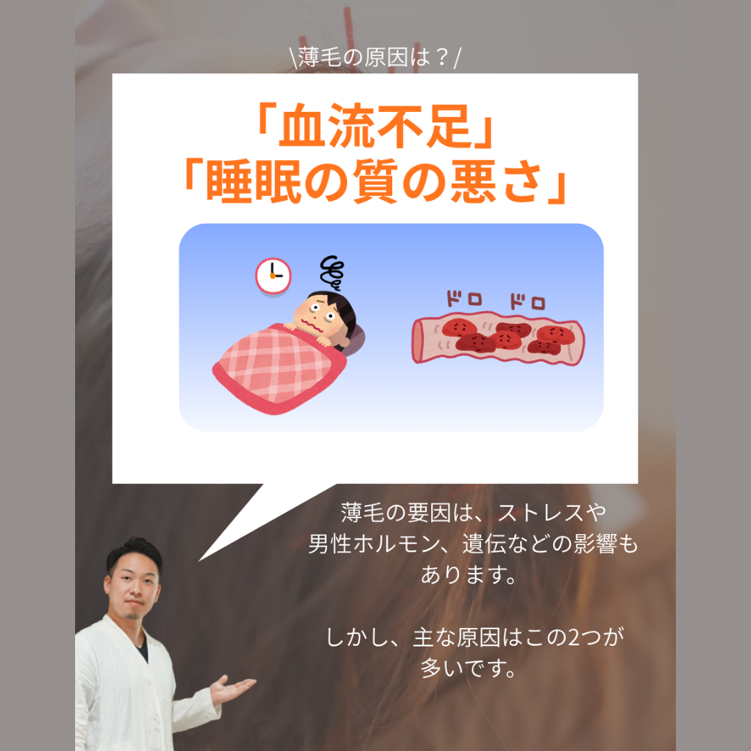 【薄毛の始まりはここからだった!】