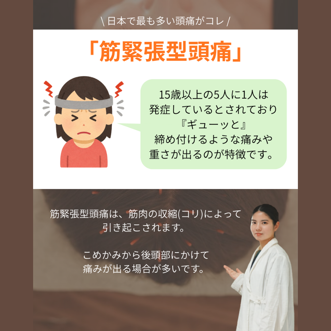 【日本で最も多い頭痛は、コレ】