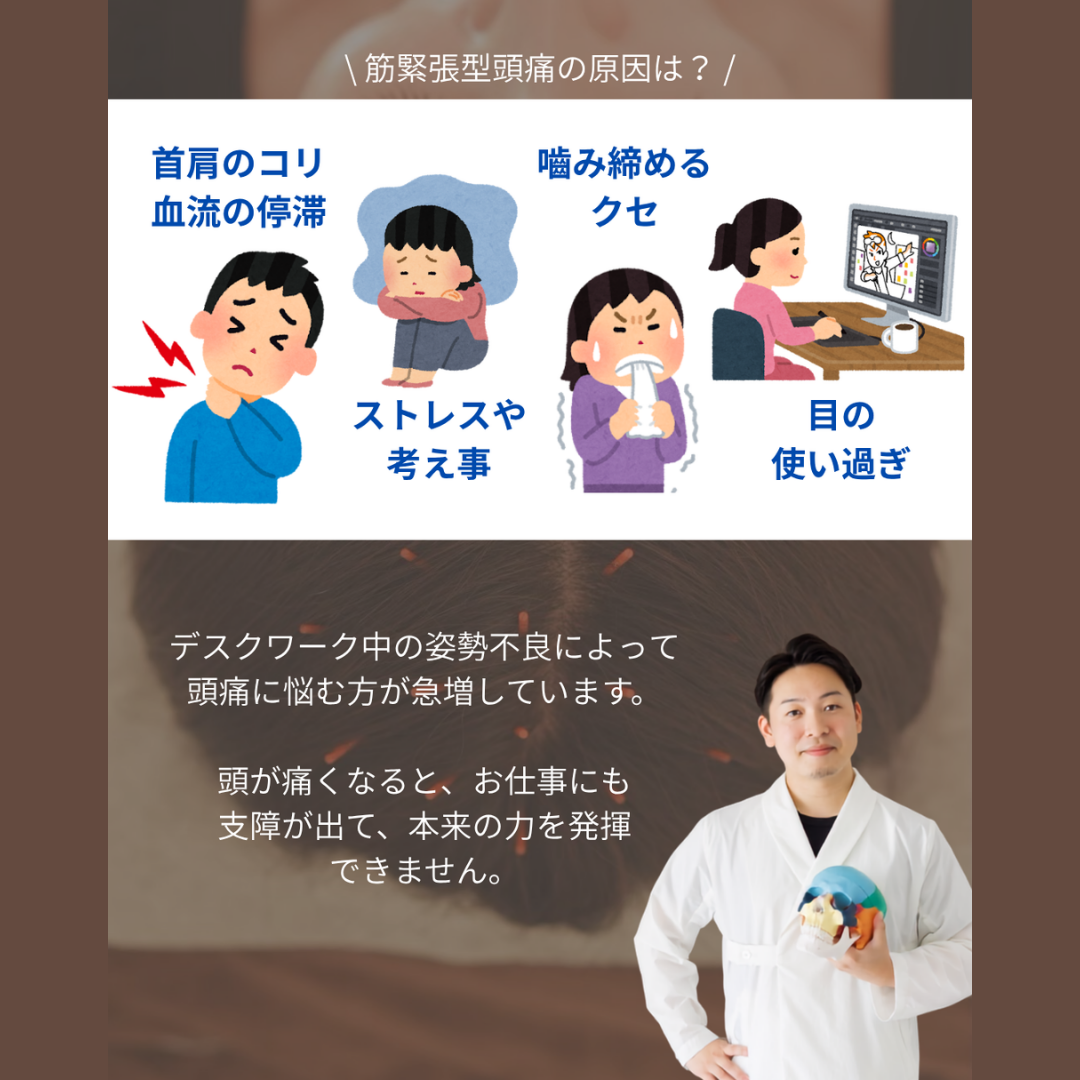 【日本で最も多い頭痛は、コレ】