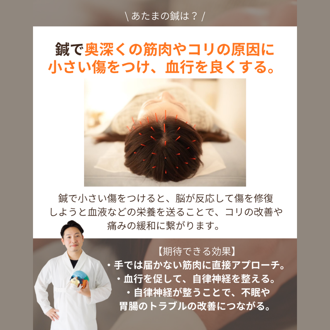 【どっちがいいの?ヘッドマッサージorあたまの鍼】